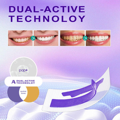 30-Min Teeth Brightening