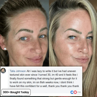 Collagen Balm | Wrinkle & Glow