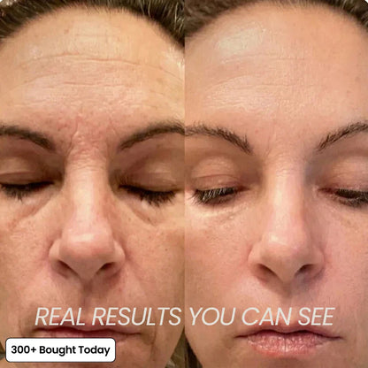 Collagen Balm | Wrinkle & Glow